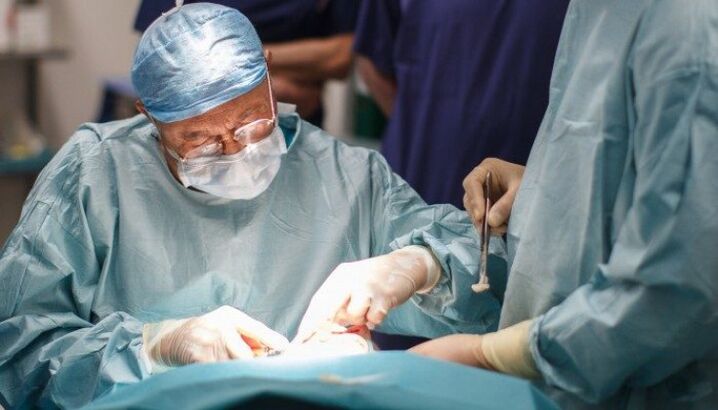 Intervento chirurgico per rimuovere l'umor vitreo dell'occhio (vitrectomia)